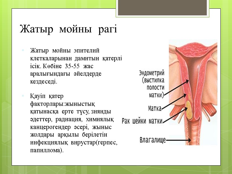 Жатыр  мойны  рагі Жатыр  мойны  эпителий  клеткаларынан  дамитын
